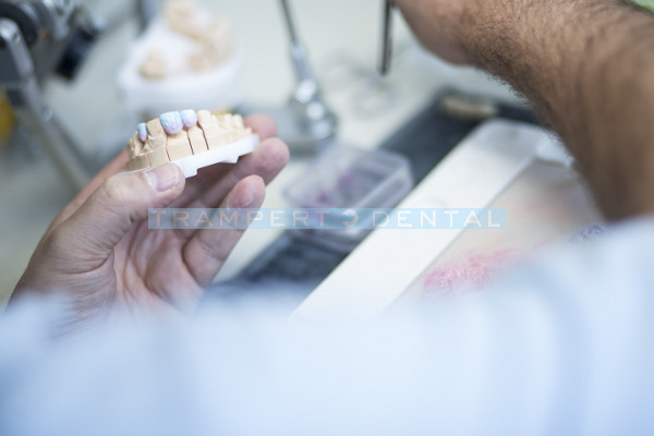 zahnprothese-dentallabor-muenchen-trampert